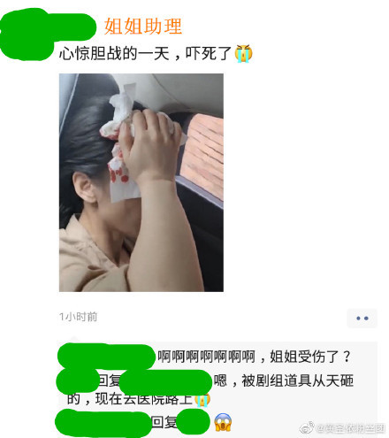 太吓人了!黄圣依拍戏时头部受伤照曝光,用纸巾紧捂血迹明显