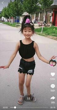7岁女孩左脚变形仍坚持跳舞，百万粉丝点赞关注 目前已来济检查 孩子，你跳舞的样子很美