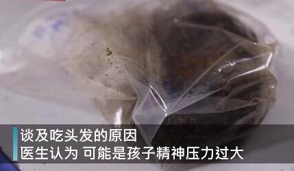 【触目惊心】女童吃头发2年塞满胃部 何种压力致使10岁女孩吃了2年头发?