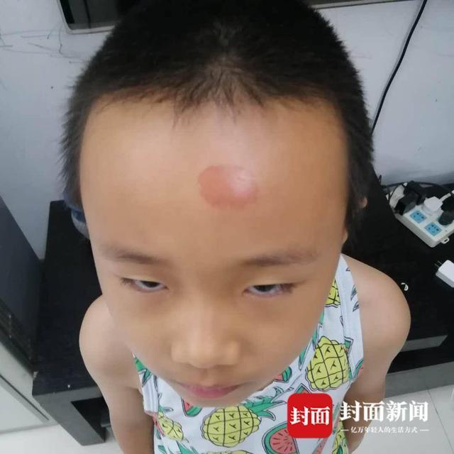 敲响安全警钟!小学误开紫外线灯灼伤学生眼睛,具体是怎么回事?