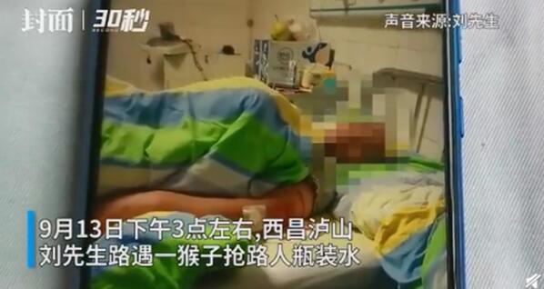 堪比悍匪！男子见义勇为被猴群报复，景区回应：可报销医疗费