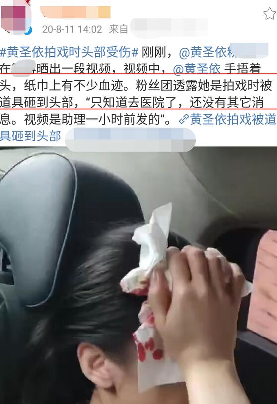 蔡少芬录节目时被狗咬伤，本人回应来了，具体是啥情况？