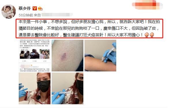 蔡少芬录节目时被狗咬伤，本人回应来了，具体是啥情况？