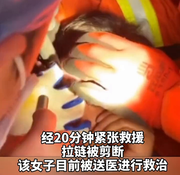 太疼了!杭州一女子眼皮被拉链夹住,求助消防