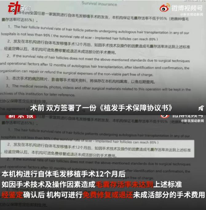 男子花2万多植发，11个月后仍头秃，状告植发机构败诉