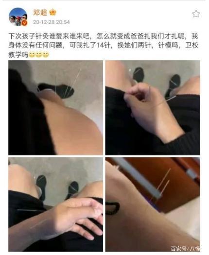 邓超慌了!邓超看见孙俪的针灸模型问逃不逃,是你你逃不逃?
