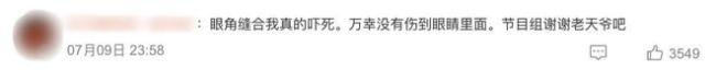 杨幂受伤退出《狐妖小红娘》？制片人：纯属谣言