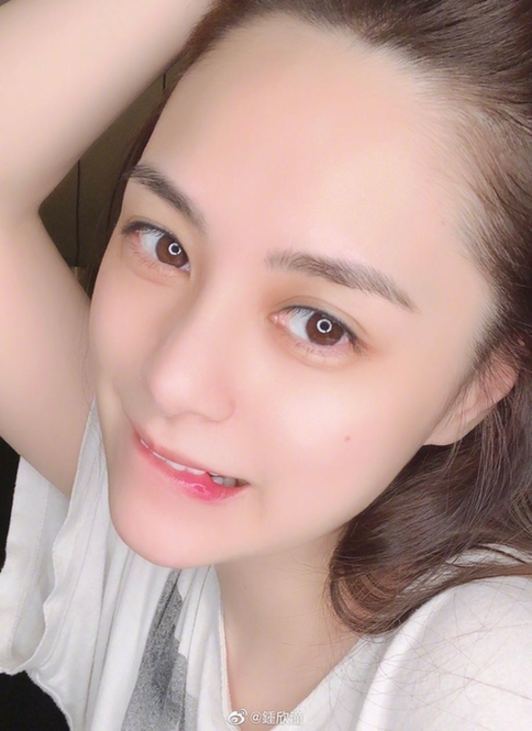 阿娇头部表面一层已缝66针什么情况?在酒店房间究竟发生了什么?