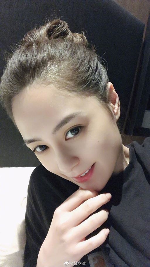 阿娇头部表面一层已缝66针什么情况?在酒店房间究竟发生了什么?