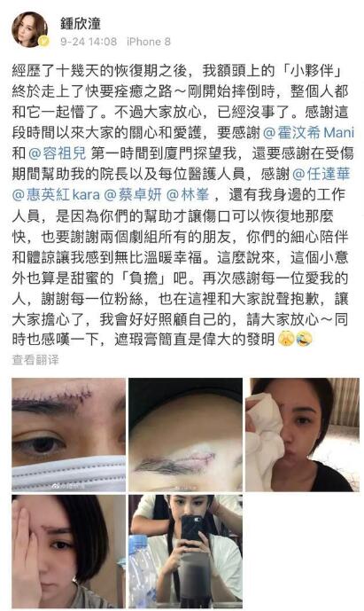 【触目惊心】阿娇晒伤口照片 在酒店房间究竟发生了什么? 