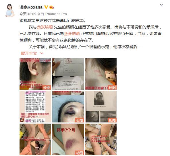 震惊！短跑名将张培萌被控诉家暴：孕期家暴 殴打岳母 离婚夺子