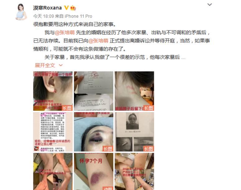 【恐婚】短跑名将张培萌被控诉家暴 张培萌妻子说了什么
