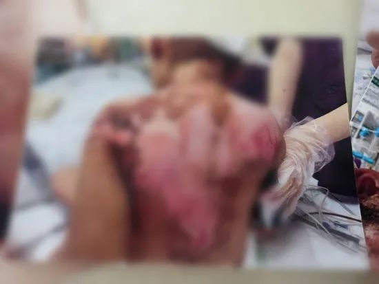 令人发指!6岁女童遭生母及其男友残忍虐待,抚顺市回应6岁女童受虐案
