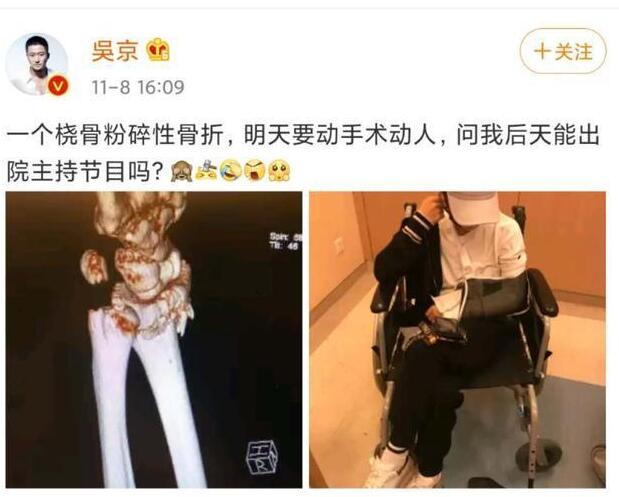 拼命三娘！吴京曝谢楠桡骨粉碎性骨折还想工作 粉丝：太让人担忧了