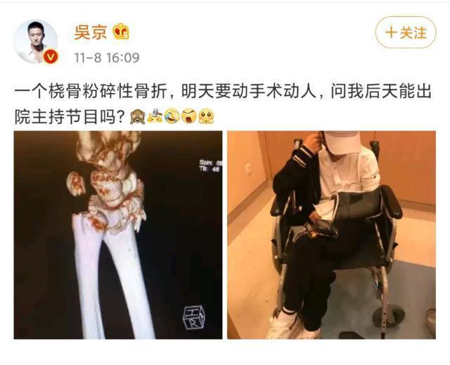 太拼了!吴京曝谢楠桡骨粉碎性骨折