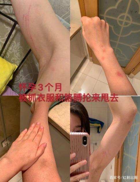 家暴只有0次和无数次!张培萌妻子谈产后第17天被家暴 