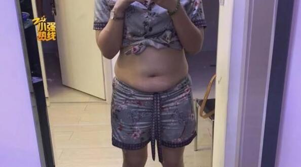 140斤的姑娘抽脂减肥，一次性抽掉4000毫升脂肪，结果却……