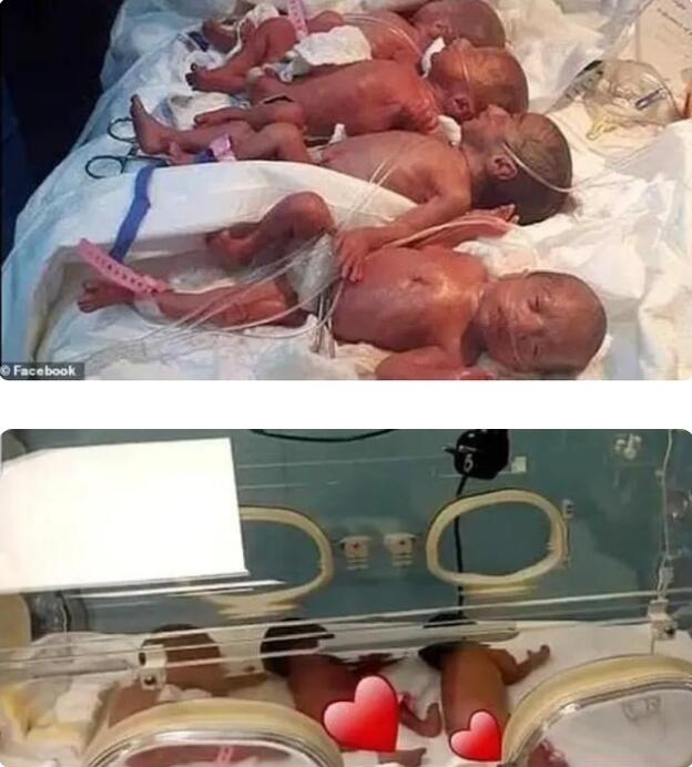 生命的奇迹！非洲妈妈一胎生下5女4男